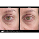 Load image into Gallery viewer, Marini Luminate® Eye Gel
