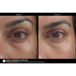 Load image into Gallery viewer, Marini Luminate® Eye Gel
