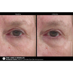 Load image into Gallery viewer, Marini Luminate® Eye Gel
