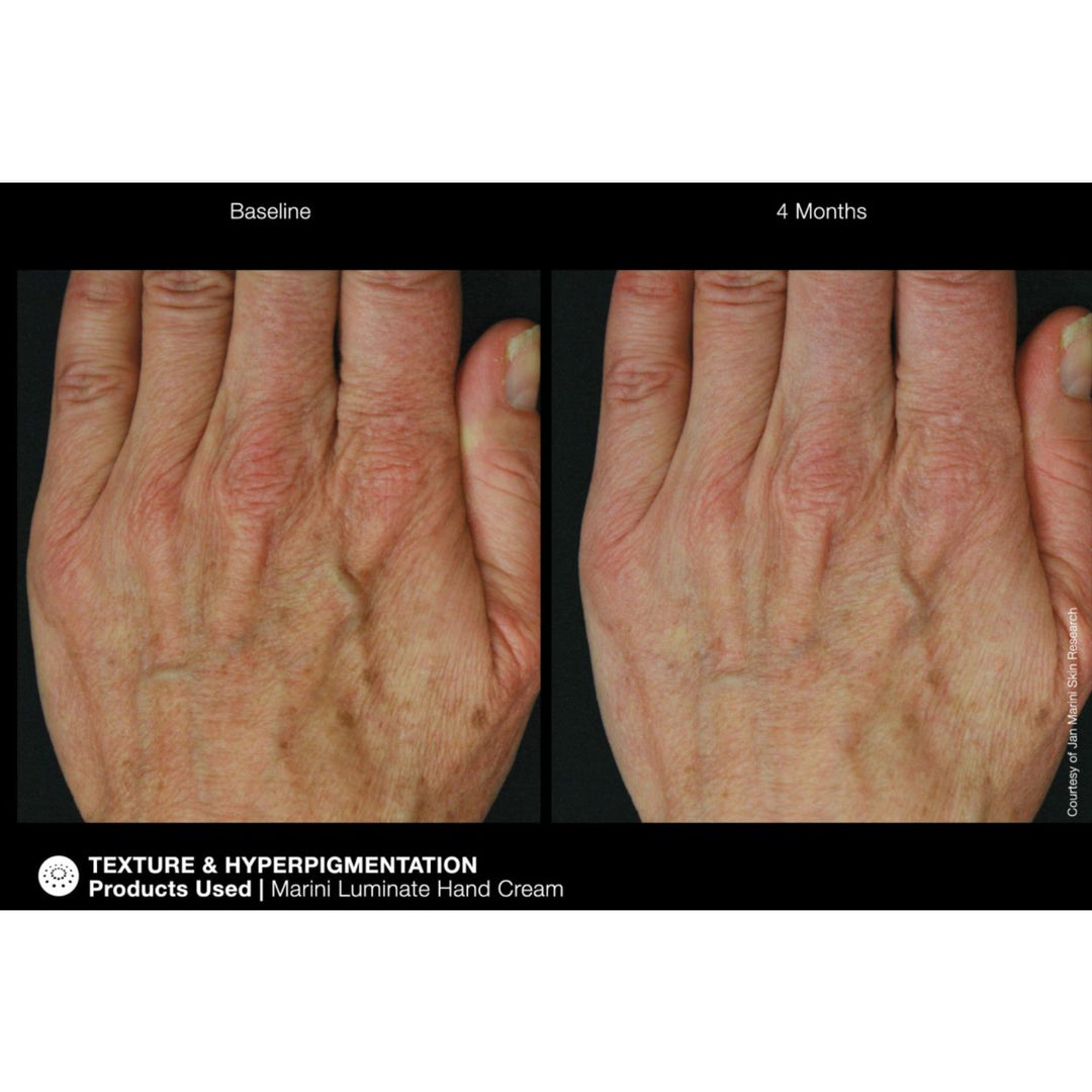 Marini ReNu Corrective Hand Complex