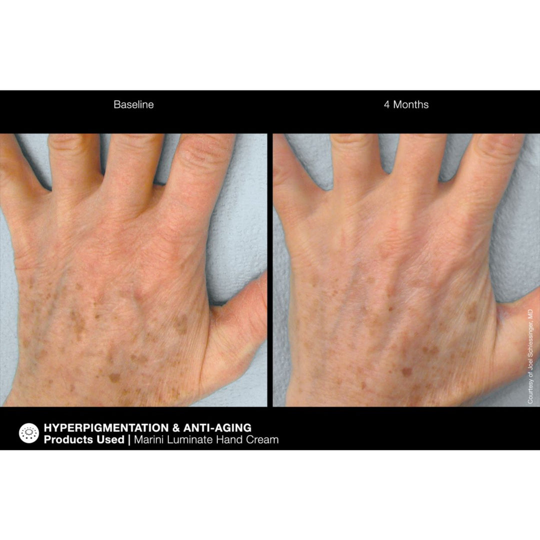 Marini ReNu Corrective Hand Complex