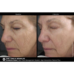 Load image into Gallery viewer, Age Intervention® Retinol Plus
